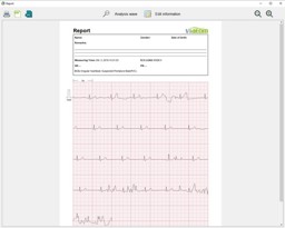 Show details for Heartmate - PC-Reporting Software Picture of Heartmate - PC-Reporting Software