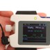 Picture of Contec RS01 Wrist Watch Sleep apnea Monitor