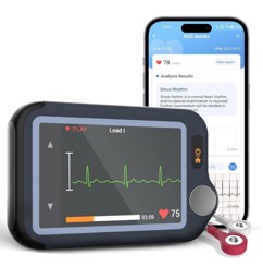 Zeige Details für Healthmonitor / EKG-Monitor bzw. Rekorder Viatom Checkme Plus