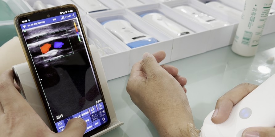 Viatom Ultrasound CProbe8P mit Smartphone Viatom Ultrasound CProbe8P mit Smartphone