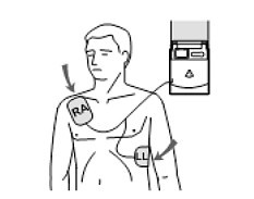 Zeige Produkte für Kategorie Defibrillatoren / AED's Bild für Kategorie Defibrillatoren / AED's