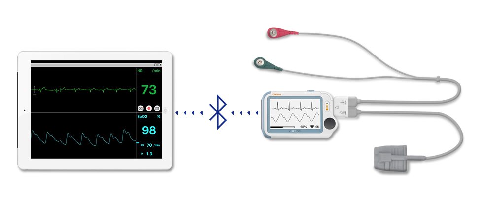 Viatom Checkme Pro: the Medical Vital Signs Monitor