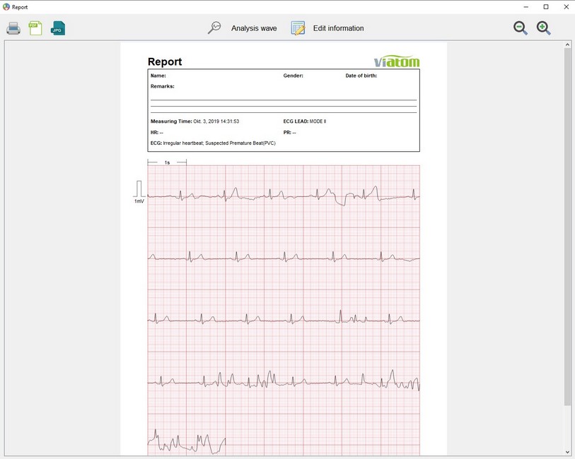 Picture of Heartmate - PC-Reporting Software