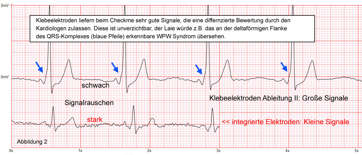 Erfahrungsbericht mit dem Viatom Checkme Pro