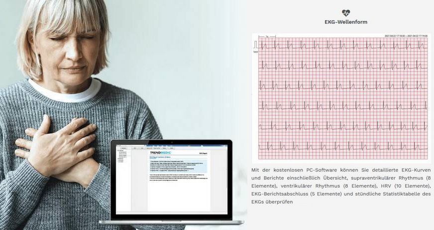 EKG-Langzeit-Tracker-Viatom ER1