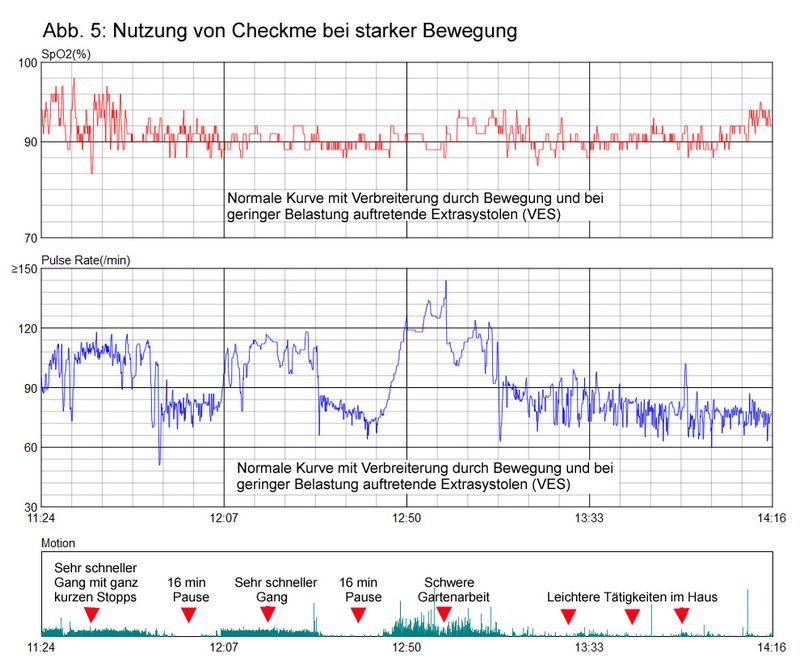 PC-Auswertung Daten Checkme O2 - O2 Ring