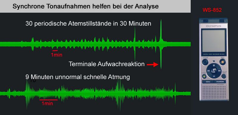 Tonaufnahme bei Schlafapnoe