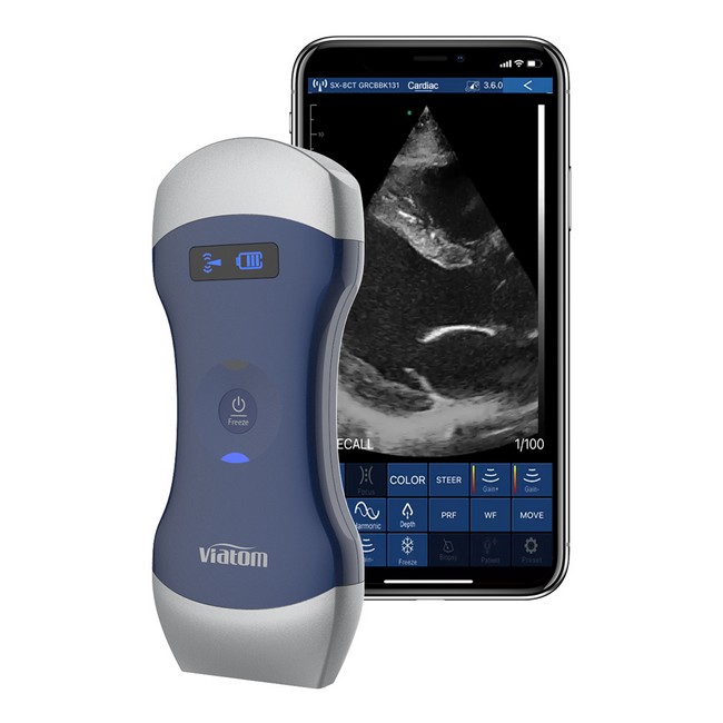 Medizinisches Ultraschallgerät / Sonographiegerät kaufen