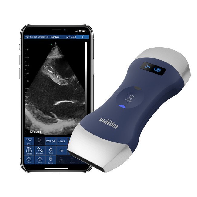 Mobile Ultraschallgeräte  mobiles Ultraschall Diagnosegerät