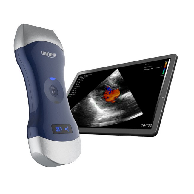 Picture for category Ultrasound