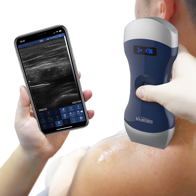 Picture of Viatom Dual-Head Wireless Portable Doppler Ultrasound (Modell 2024)