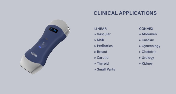 Ultraschallgerät portabel / Sonographiegerät - mobiles Sonogerät / Sonostar  Uprobe-C 4PL, Viatom Eagleview-Healthcare