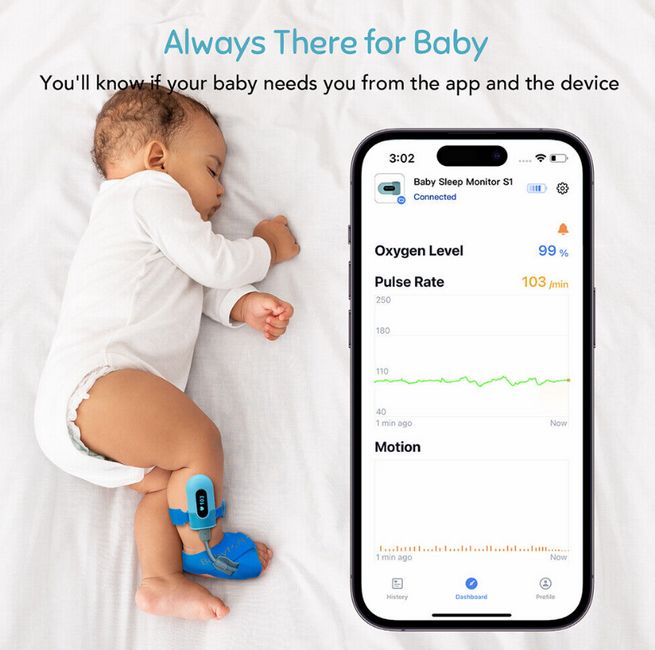 Infant Pediatric Pulse Oximeter - BabyO2 PO5