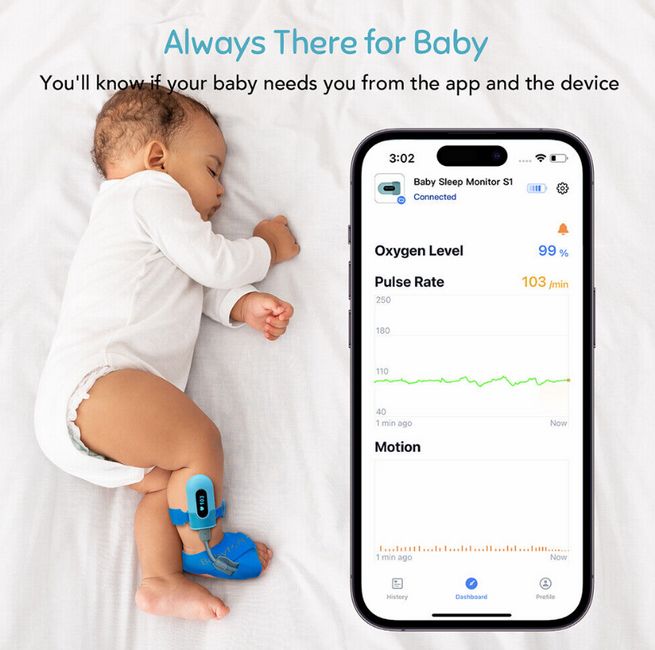  BabyO2 - Monitor de oxígeno para bebé (para colocarlo en el  pie), con alarma en la aplicación, con seguimiento de nivel de O2 y  frecuencia cardíaca; monitor de saturación de oxígeno