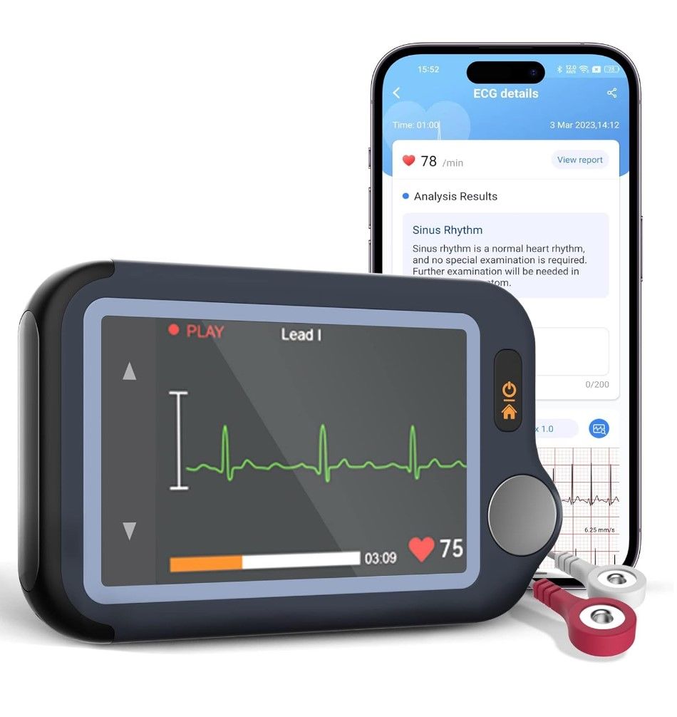 CheckMe BP2 Connect Wireless Blood Pressure and ECG Monitor REVIEW 