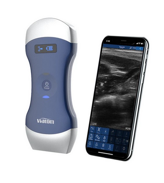 Picture of Viatom Dual-Head Wireless Portable Doppler Ultrasound (Modell 2025)